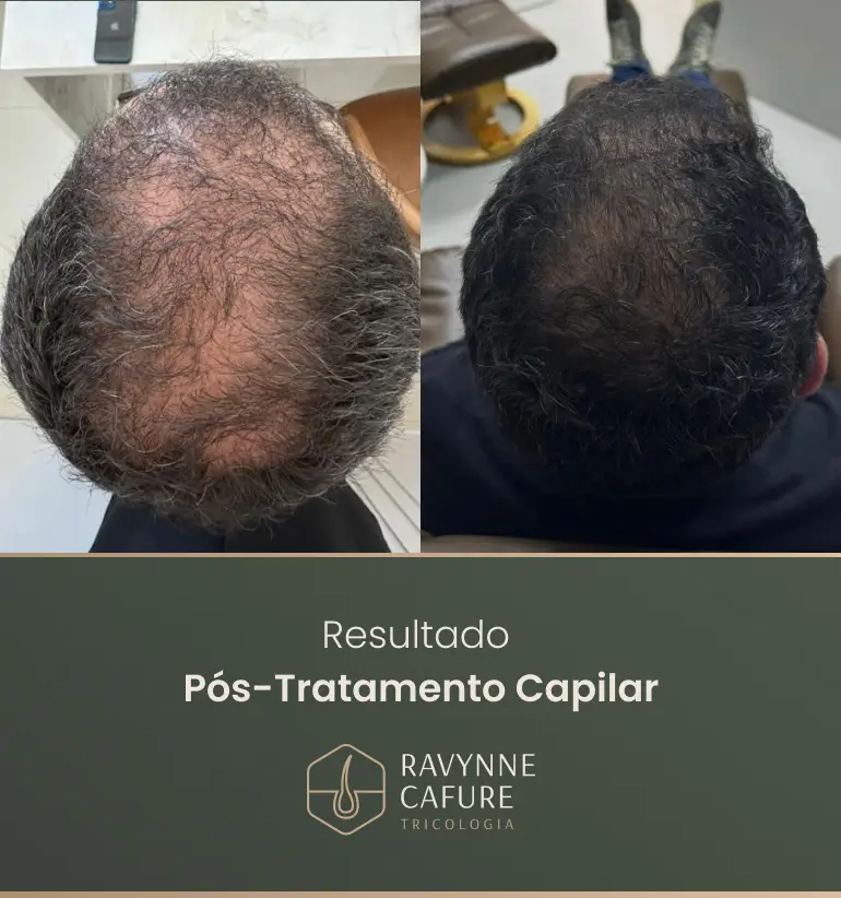 RG - antes e depois 01