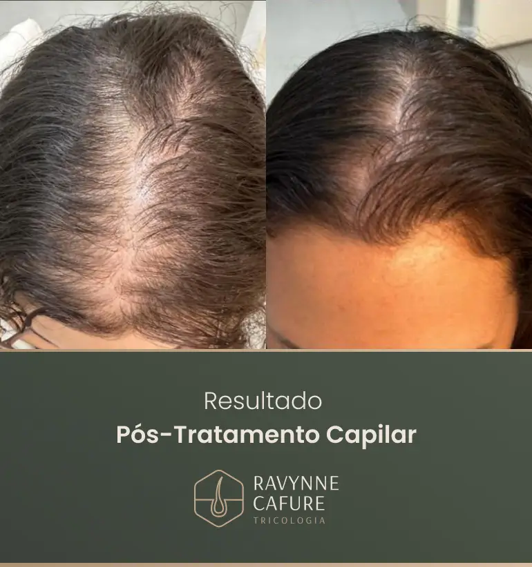 RG - antes e depois 10