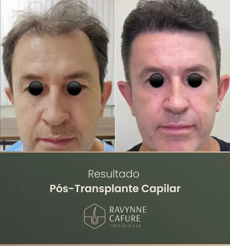 RG - antes e depois 2