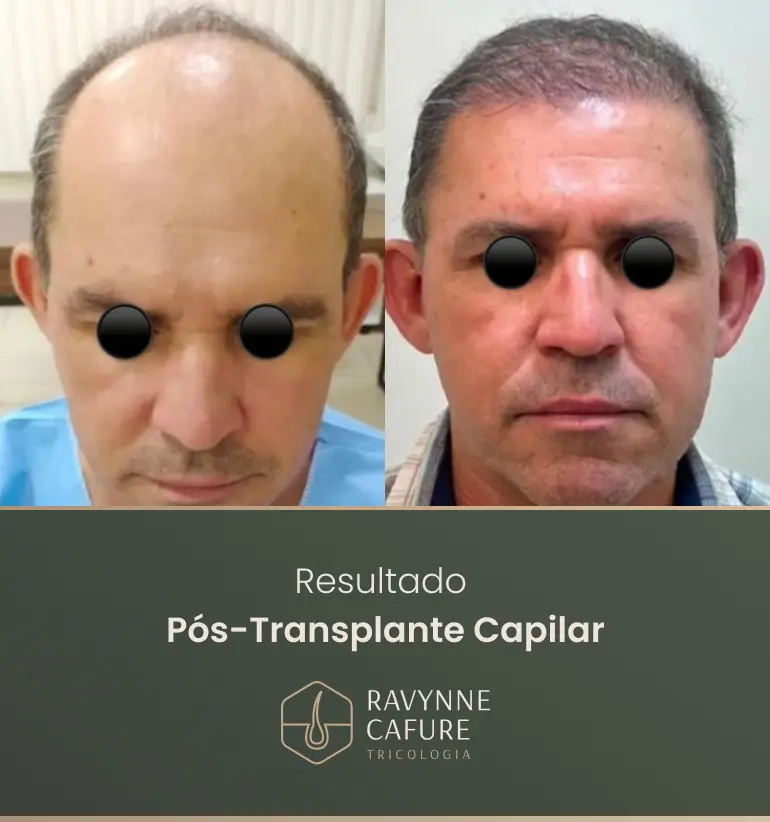 RG - antes e depois 3