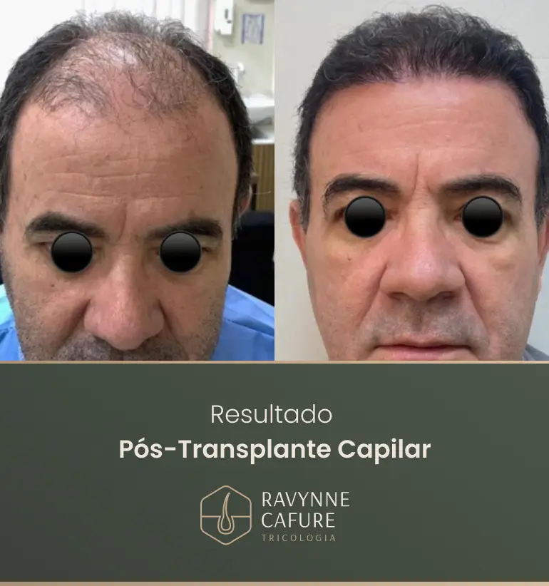 RG - antes e depois 5