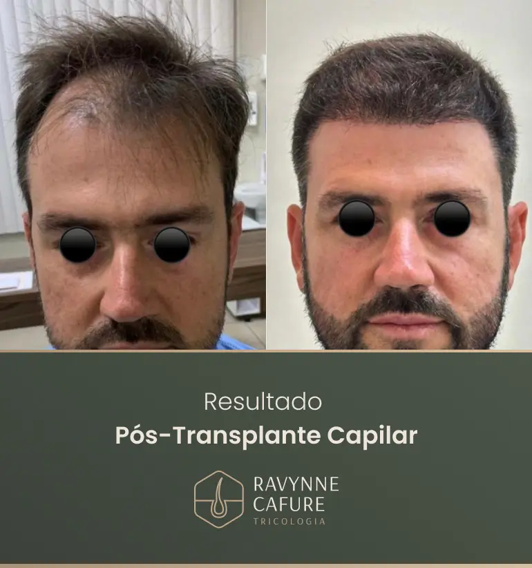 RG - antes e depois 6