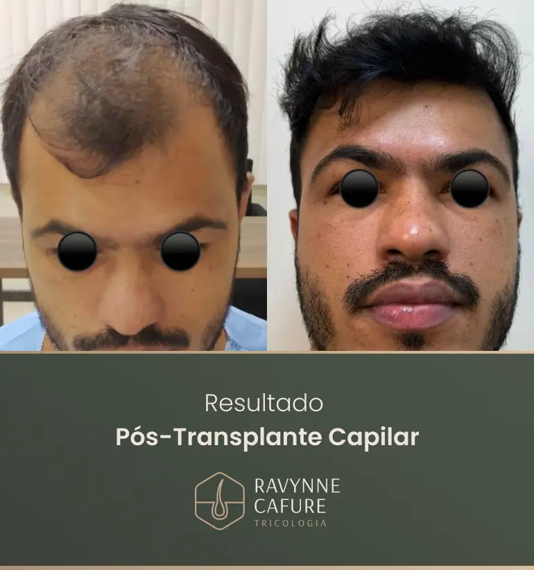 RG - antes e depois 7