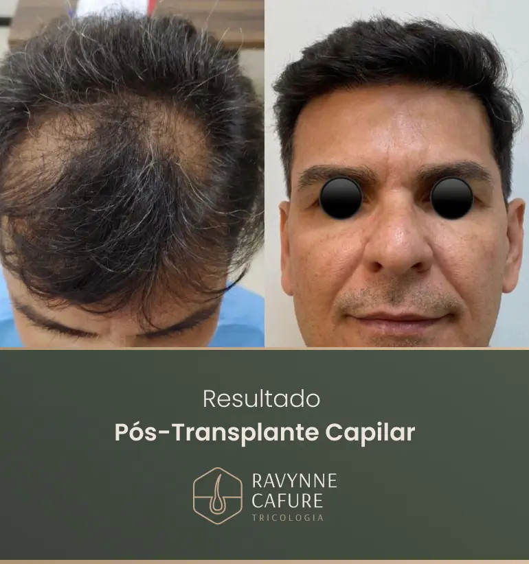 RG - antes e depois 8